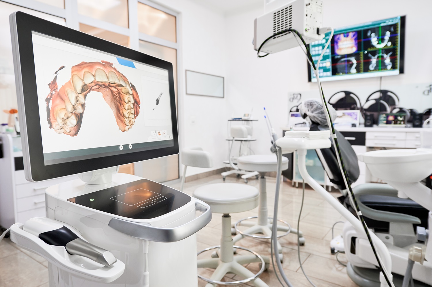 A modern dental office features advanced equipment, including a digital screen displaying a 3D model of a dental arch - South Bay Endodontics